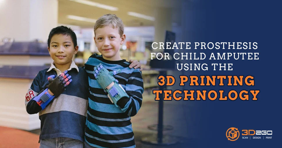 Prosthesis For Child Amputee