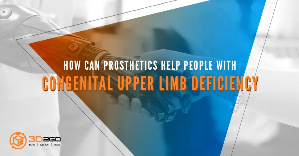 Prosthetics For People With Congenital Upper Limb Deficiency