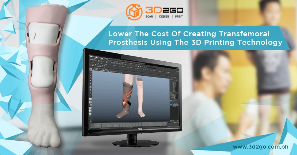 3D Printed Prosthetics