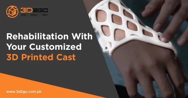 Rehabilitation With Your Customized 3D Printed Cast