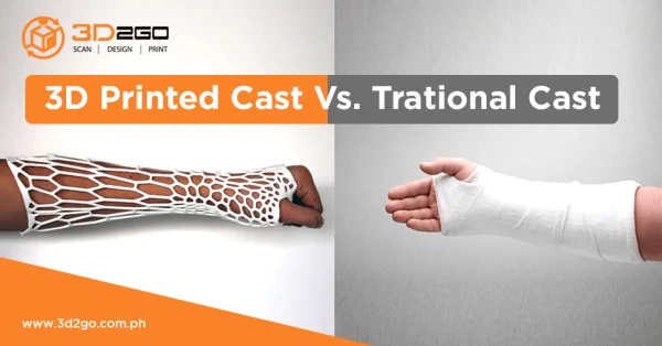 3D Printed Cast Vs. Trational Cast